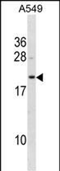 BLVRB Antibody (Center)