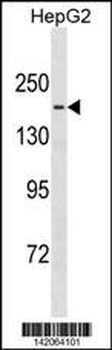 TTBK1 Antibody (Center)