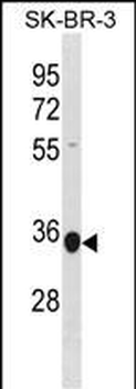 MRPL45 Antibody (C-term)
