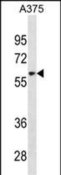 ZNF394 Antibody (Center)