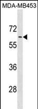 ADRA1B Antibody (C-term)