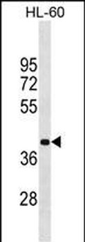 MBD2 Antibody (Center)