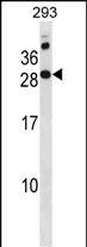 RAP2C Antibody(N-term)