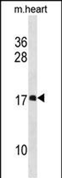 DAPL1 Antibody(N-term)
