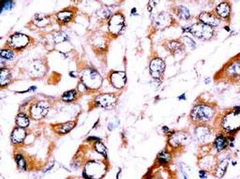 HDBP2(HDRF-2) Antibody (Center)