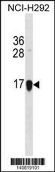 HIST1H2BJ/HIST1H2BK/HIST3H2BB Antibody(C-term)