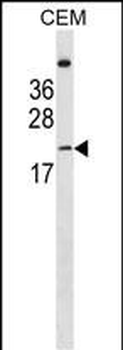 LIN7B Antibody (N-term)