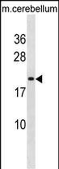 LIN7B Antibody (N-term)