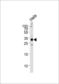 RPS6 Antibody (N-term)