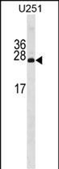 PDAP1 Antibody (N-term)
