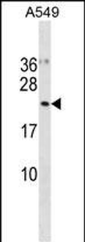UFC1 Antibody (N-term)