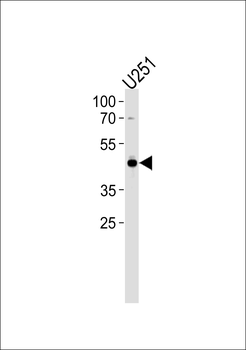 AP2 alpha Antibody (N-term)
