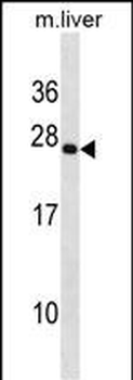 PRRX2 Antibody (C-term)