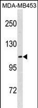 ENPP3 Antibody(C-term)