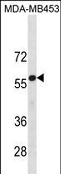 UGT2B4 Antibody(N-term)