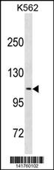 CLSTN2 Antibody(Center)