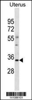OR6S1 Antibody(C-term)