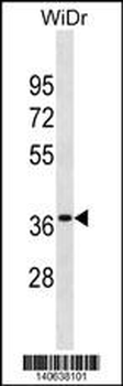 OR6K3 Antibody(N-term)