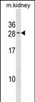VPS25 Antibody(C-term)