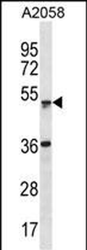 ZSCAN21 Antibody(Center)