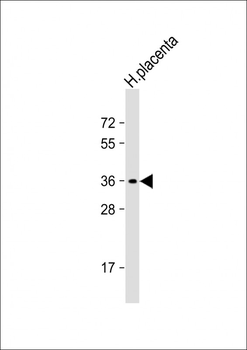 OR8A1 Antibody(N-term)