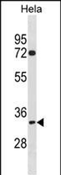 TIPIN Antibody(N-term)