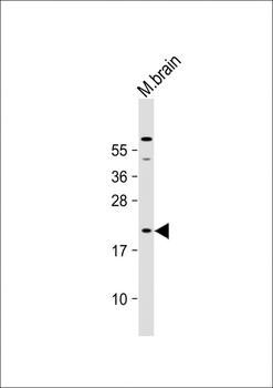 Mouse Hras1 Antibody(C-term)