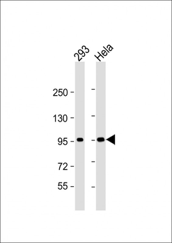 CTNNB1 Antibody(C-term)