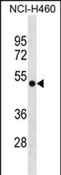 GTPBP3 Antibody(Center)