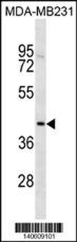 TOX2 Antibody(Center)
