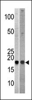 NCBP2 Antibody (N-term)