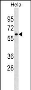 ZNF410 Antibody(C-term)