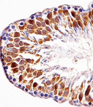 Mouse Pbk Antibody(N-term)