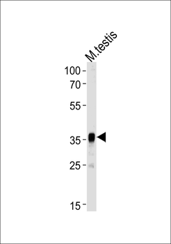 Mouse Pbk Antibody(N-term)
