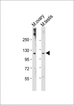 Mouse Lats2 Antibody(C-term)
