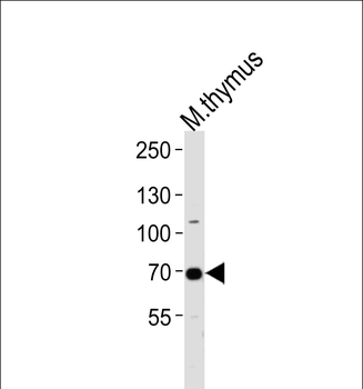 Mouse Ephb6 Antibody(Center)