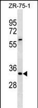 ING2 Antibody(Center)