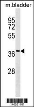 Mouse Tmem158 Antibody (Center)
