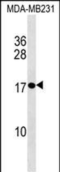 PLAC1 Antibody (C-term)