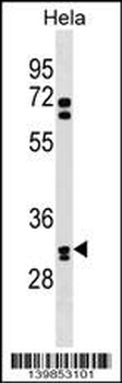 OR6B2 Antibody (C-term)