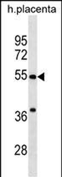 CHST2 Antibody (C-term)