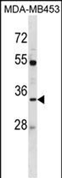 AQP3 Antibody (Center)
