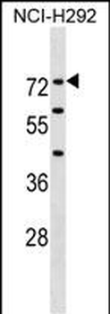 F12 Antibody (N-term)