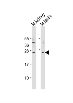 Mouse Trem2 Antibody (N-term)