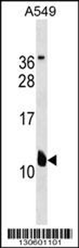 KCNE2 Antibody (C-term)