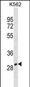 ZNF365 Antibody (Center)