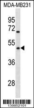 OR1Q1 Antibody (C-term)
