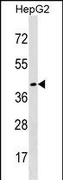 DHH Antibody (Center)