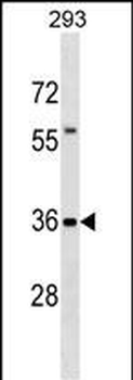 TFG Antibody (Center)