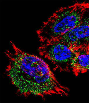 MRPL28 Antibody (N-term)
